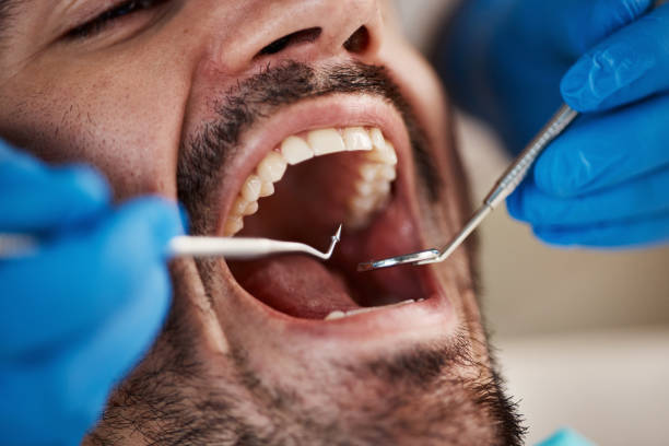 Best Emergency Treatment for Oral Infections in Farmington, UT